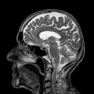 fMRI brain scan neuromarketing research